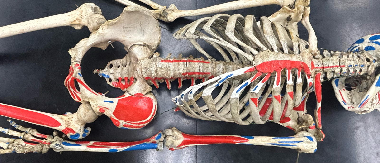 Forensics Project to Carry Out Anthropological Assessment of Unidentified Human Remains