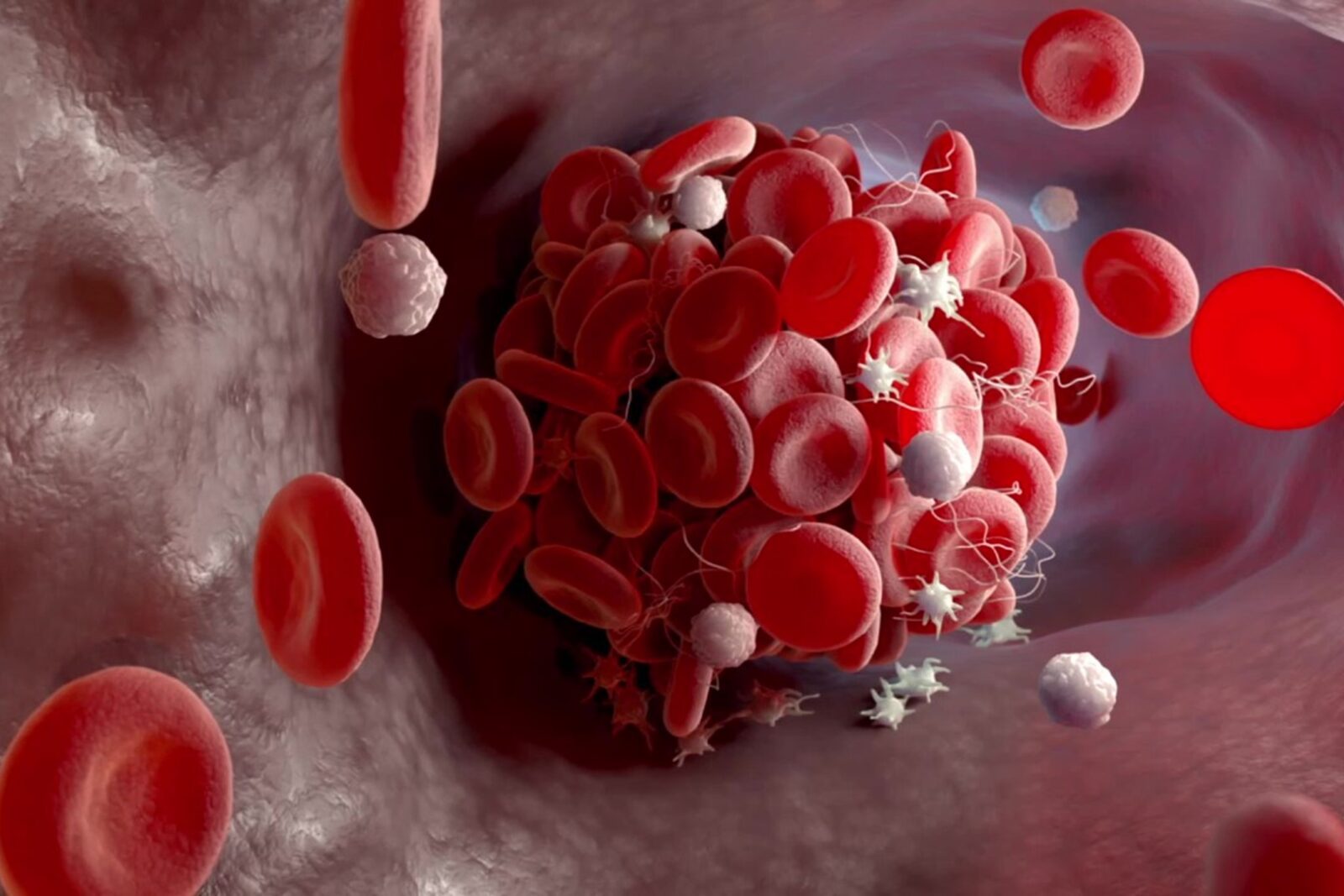 clot close-up